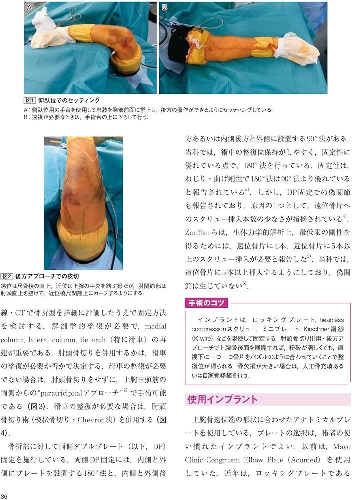 肘の外傷:診断・手術・保存療法 (整形外科SURGICAL TECHNIQUE BOOKS 11