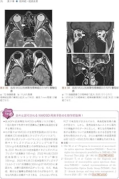 Amazon.co.jp: 神経眼科学を学ぶ人のために 第4版 : 三村 治: 本
