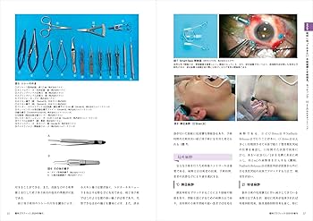 網膜硝子体手術：基本と応用，トラブル＆リカバリーがわかる！ (眼科