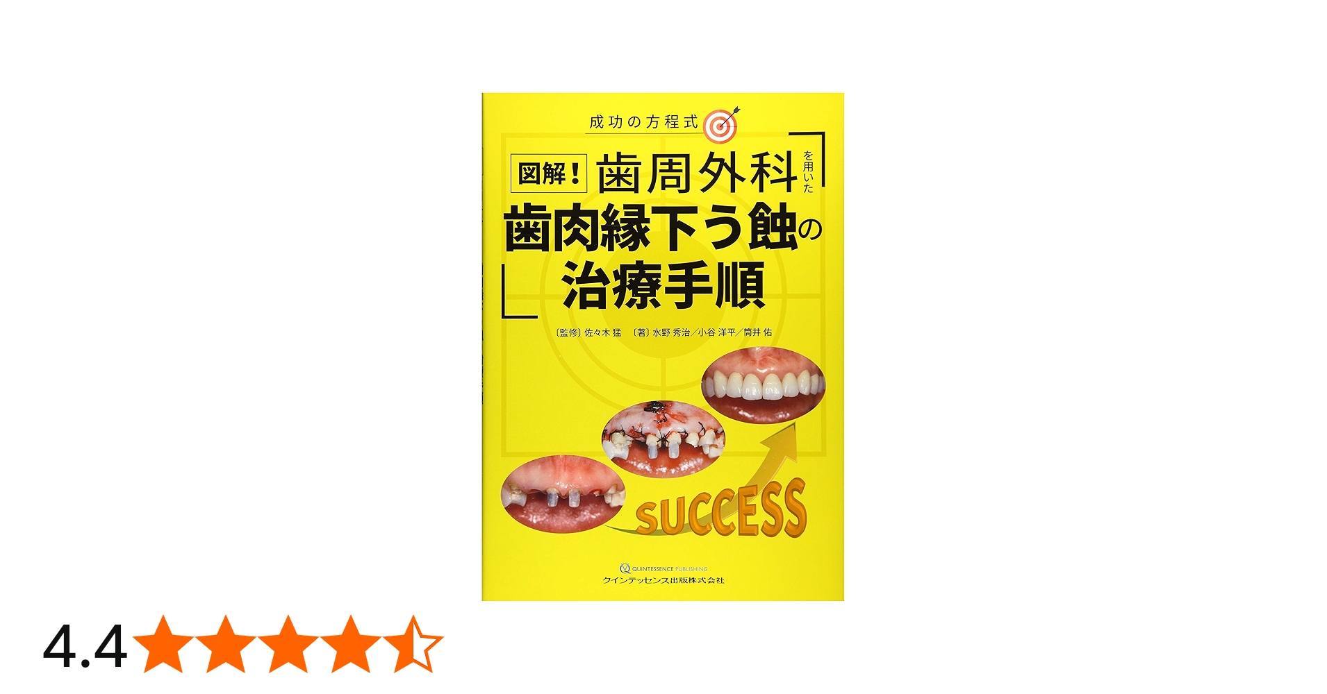 図解！歯周外科を用いた歯肉縁下う蝕の治療手順 | 水野 秀治, 小谷