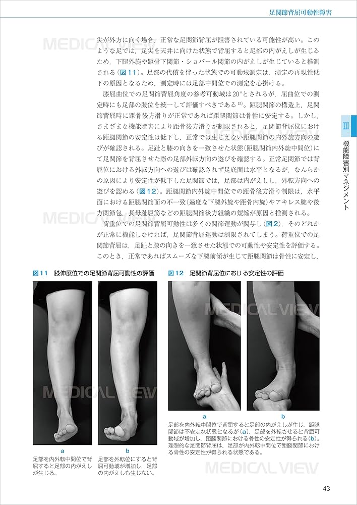 足部・足関節理学療法マネジメント−機能障害の原因を探るための臨床