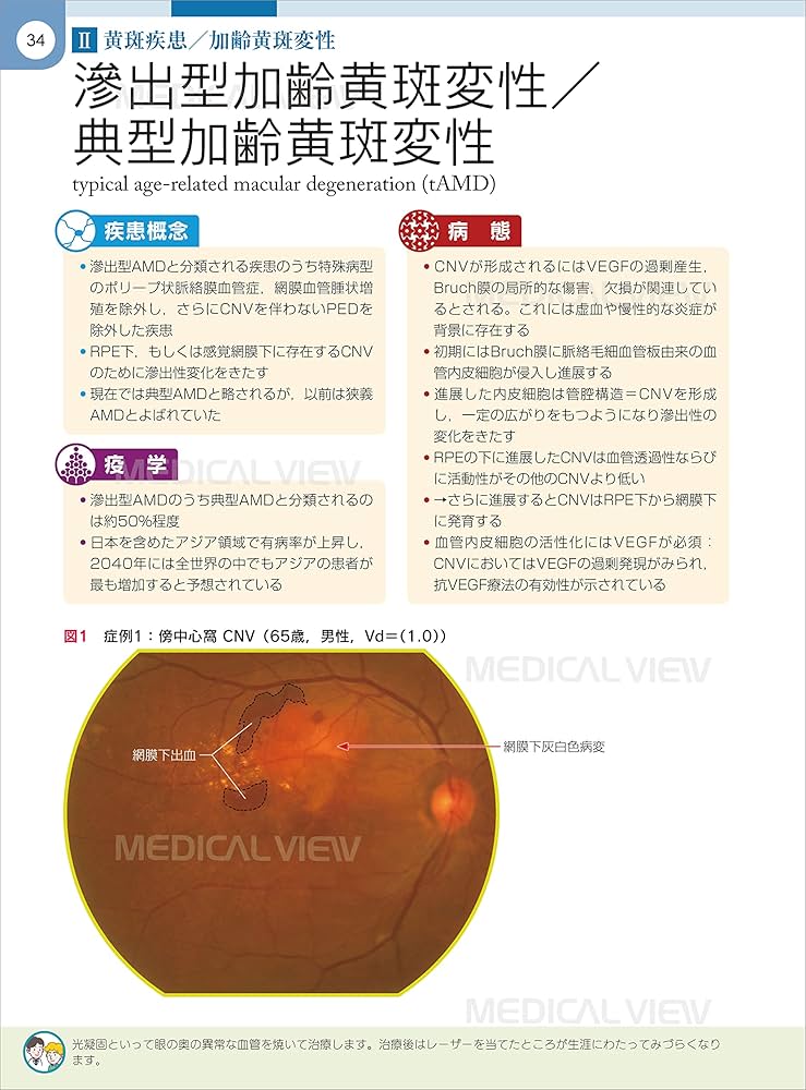 網膜診療クローズアップ 改訂第2版 | 柳 靖雄 |本 | 通販 | Amazon