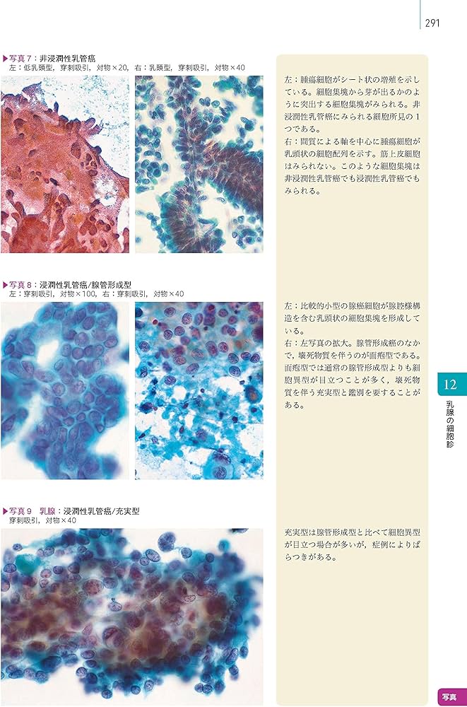 細胞診を学ぶ人のために 第6版 | 坂本 穆彦 |本 | 通販 | Amazon