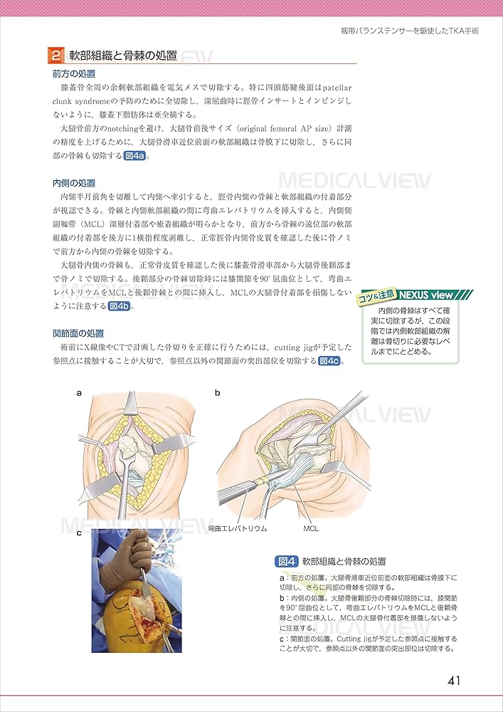 膝関節の再建法−最適な選択のために (OS NEXUS(電子版付き) 9) | 宗田