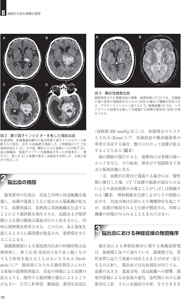 脳血管障害と神経心理学 第2版 | 平山 惠造 |本 | 通販 | Amazon