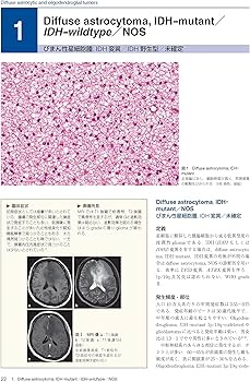 脳腫瘍臨床病理カラーアトラス 第4版 | 日本脳腫瘍病理学会, 若林俊彦