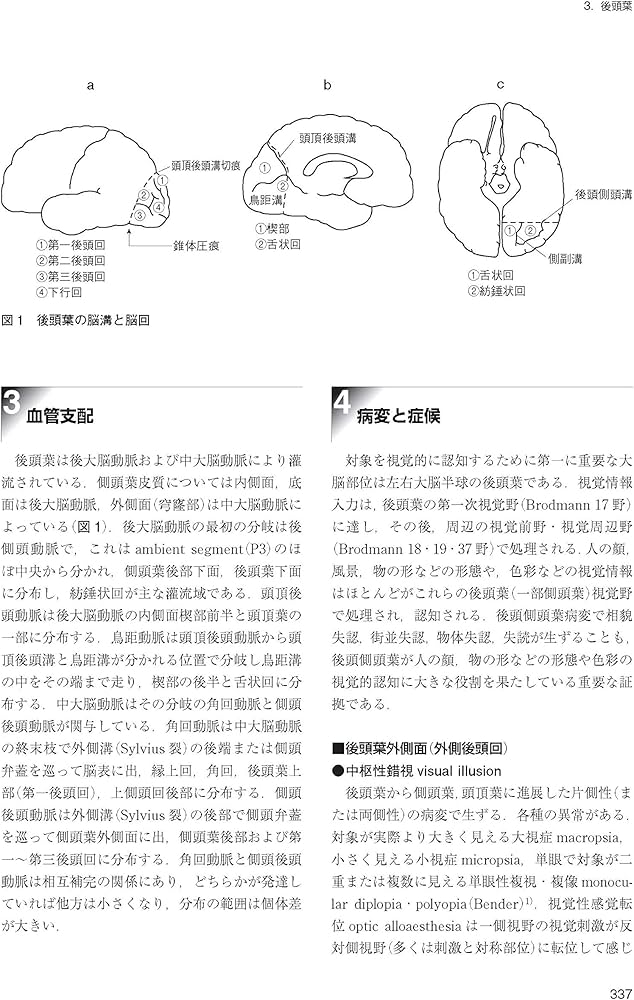 脳血管障害と神経心理学 第2版 | 平山 惠造 |本 | 通販 | Amazon