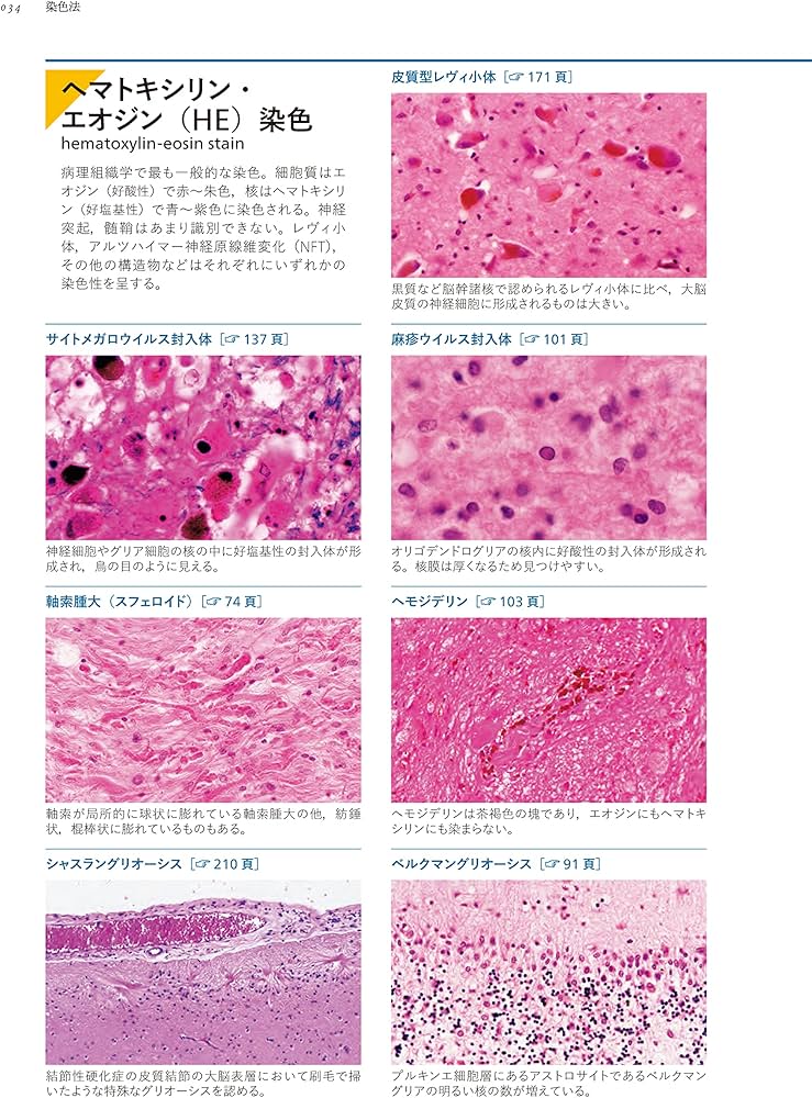 神経病理インデックス 第2版 | 新井信隆, 新井信隆 |本 | 通販 | Amazon