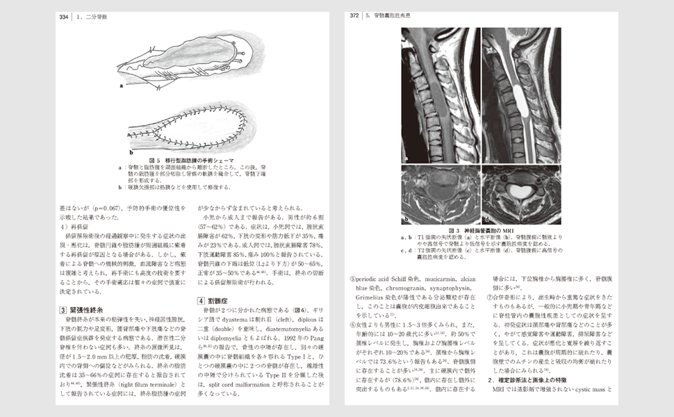 脊椎・脊髄疾患の外科 第2版 | 飛驒一利, 小柳 泉 |本 | 通販 | Amazon