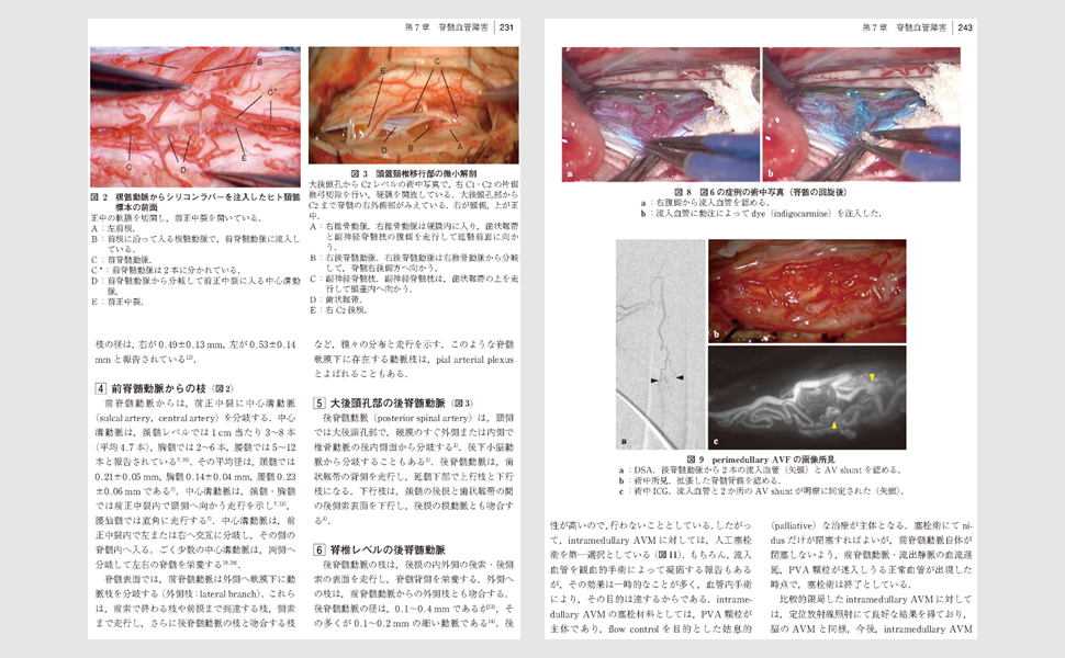 脊椎・脊髄疾患の外科 第2版 | 飛驒一利, 小柳 泉 |本 | 通販 | Amazon