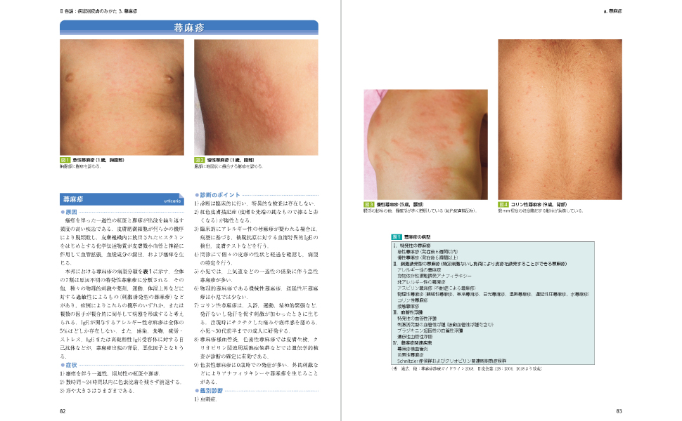 小児皮膚病アトラス | 吉田和恵 |本 | 通販 | Amazon