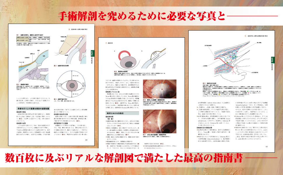 眼科医のための手術解剖 | 林篤志, 三木篤也 |本 | 通販 | Amazon