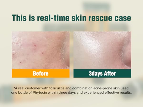 Amazon.com: VQM VIBANQUENTMANKA Lotion – Korean Moisturizer for