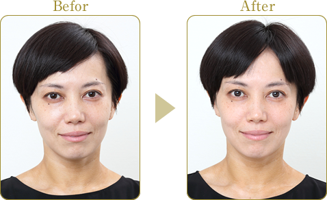 株式会社 リード モンテセラピー 製品のご案内＜モンテ リフトシーツ＞