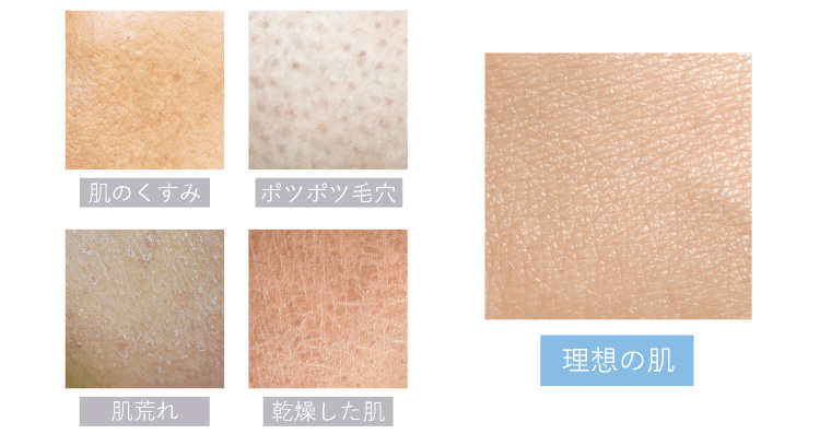 脱毛しながら美肌エステ！ミュゼの「スキンケア脱毛」って？口コミをご