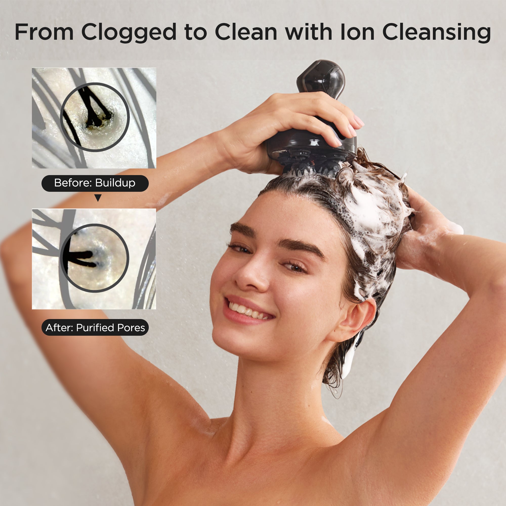 Head Spa Deep X 頭皮按摩器– MYTREX Global