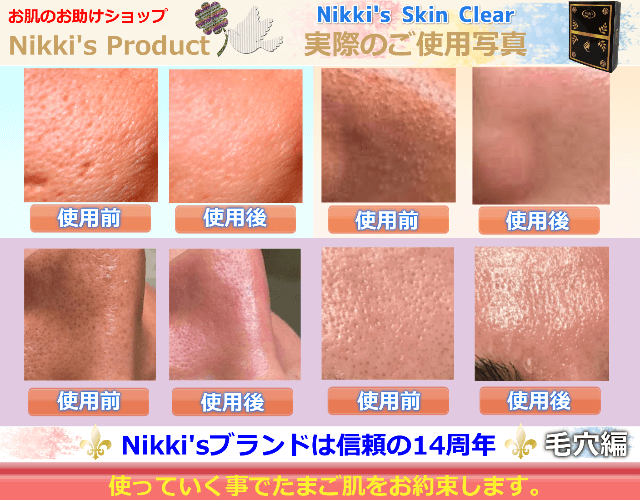 ニッキーズスキンクリア Nikki's Skin Clear メンテナンス使用 (シミ