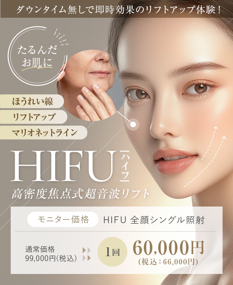 医療ハイフ（HIFU）｜KOBE美容皮膚科 西宮院