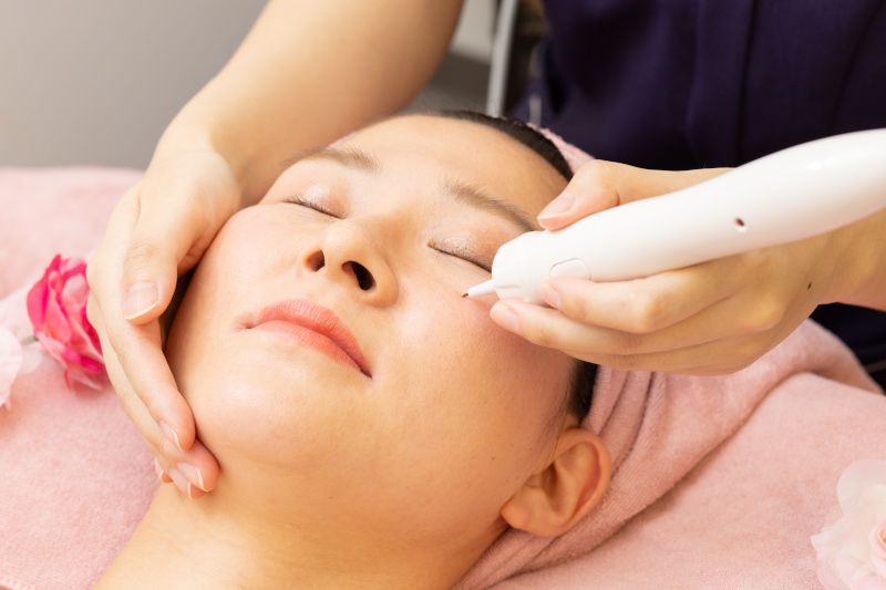 女性専用サロン NonNon 岡崎– シミ取り放題 8,500円/60分～