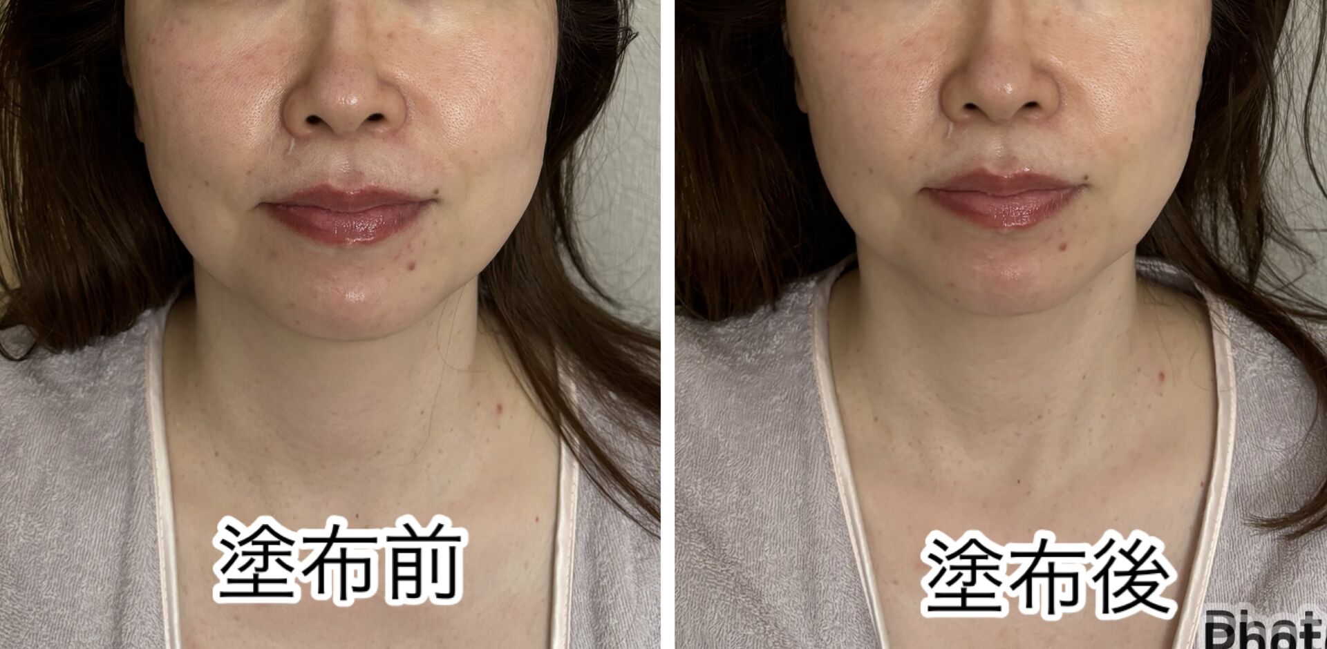 日本初上陸！Moritex リフトアップ＆タイトニングエッセンスミスト