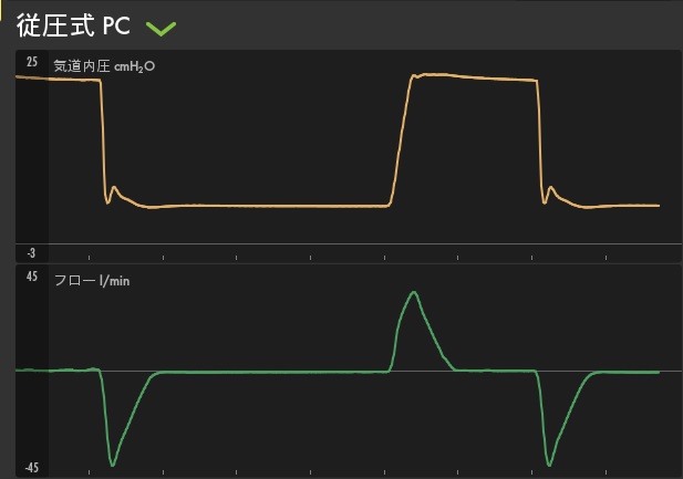 呼吸の仕組みと人工呼吸器2 【臨床工学科】 | 市立御前崎総合病院
