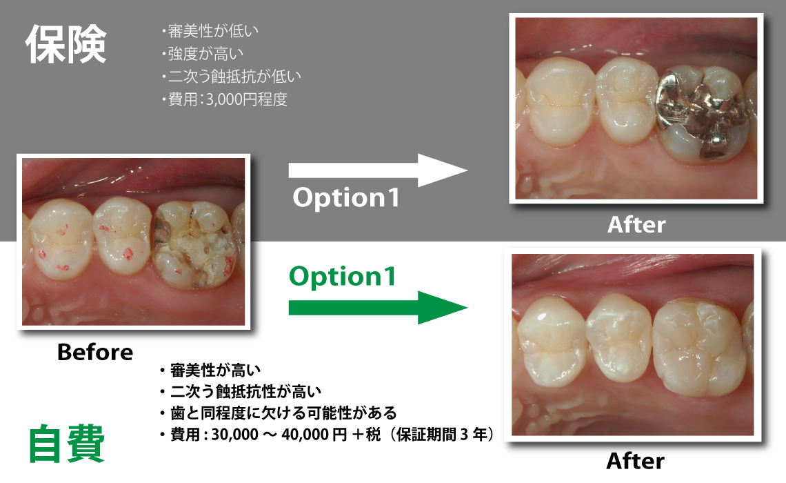 西尾市の歯科・歯医者｜大竹歯科医院 審美修復｜ 一般歯科・予防歯科