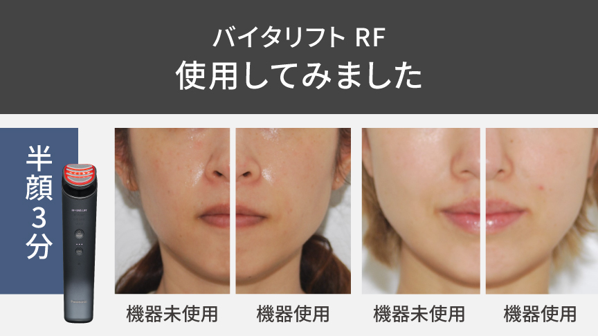 商品特長・効果 | 特長 リフトケア美顔器 バイタリフト RF EH-SR85