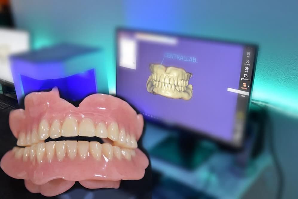 総入れ歯専門歯科のパリムデンタル│最先端のデジタル技術を大阪で