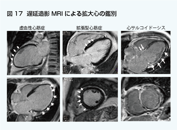心臓MRIについてのご説明 | 和歌山画像診断センター
