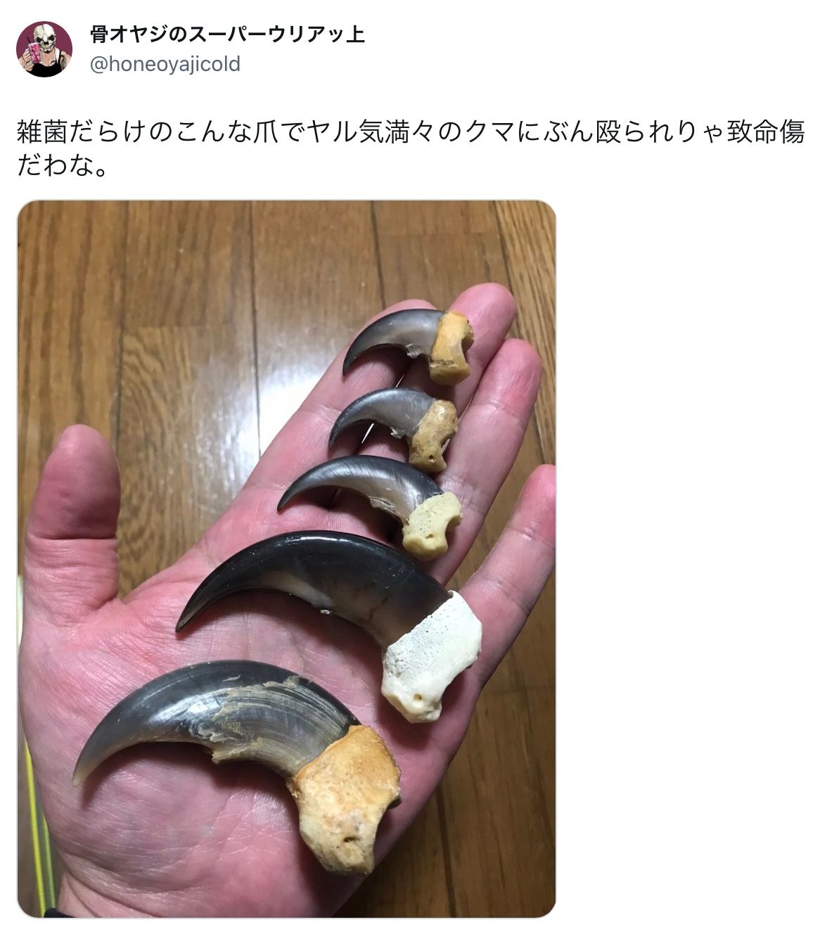 雑菌だらけのこんな爪でぶん殴られりゃ…致命傷だわな」クマの凶暴性を