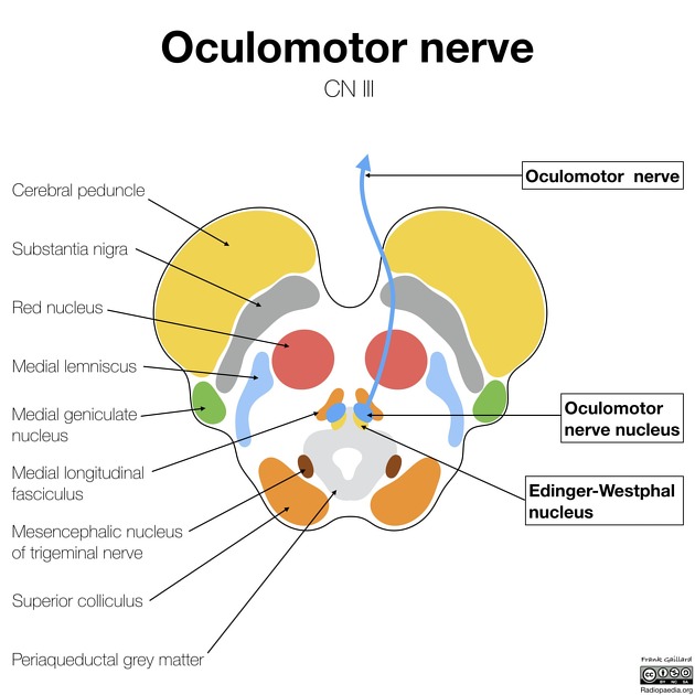 Oculomotor nerve | Radiology Reference Article | Radiopaedia.org