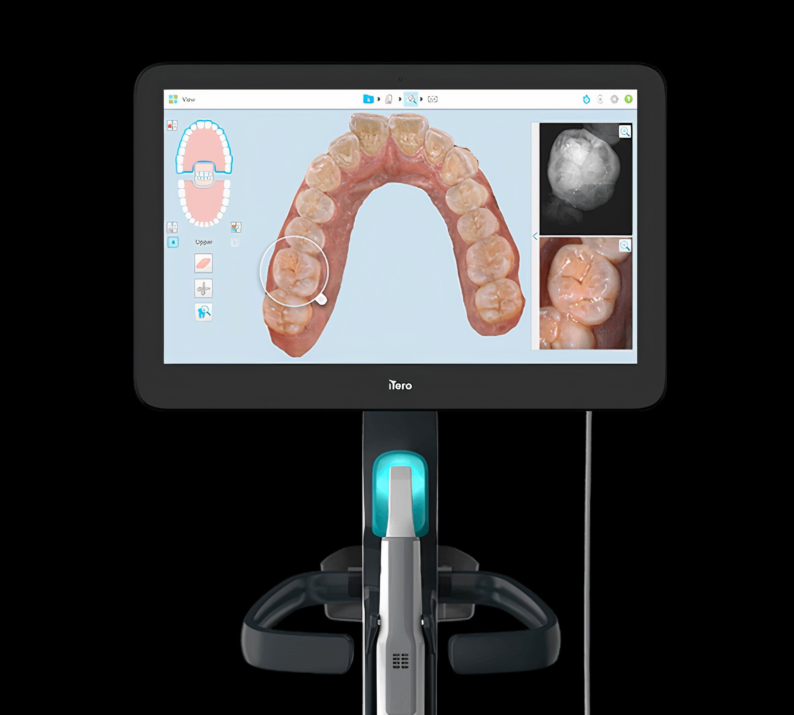 愛知県豊田市の若林歯科で「iTeroエレメント5Dプラス」を導入 | 医療
