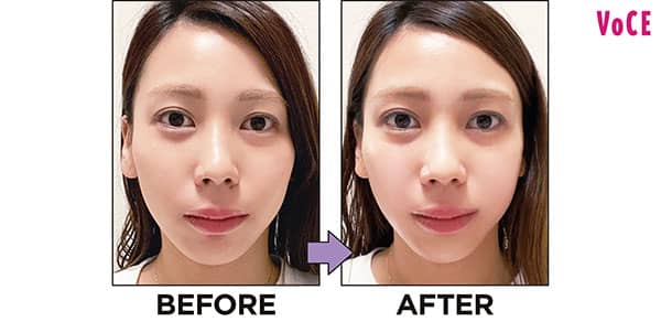 一回の使用でもすっきり！【リフトアップ美顔器】TOP3〈最新美容家電