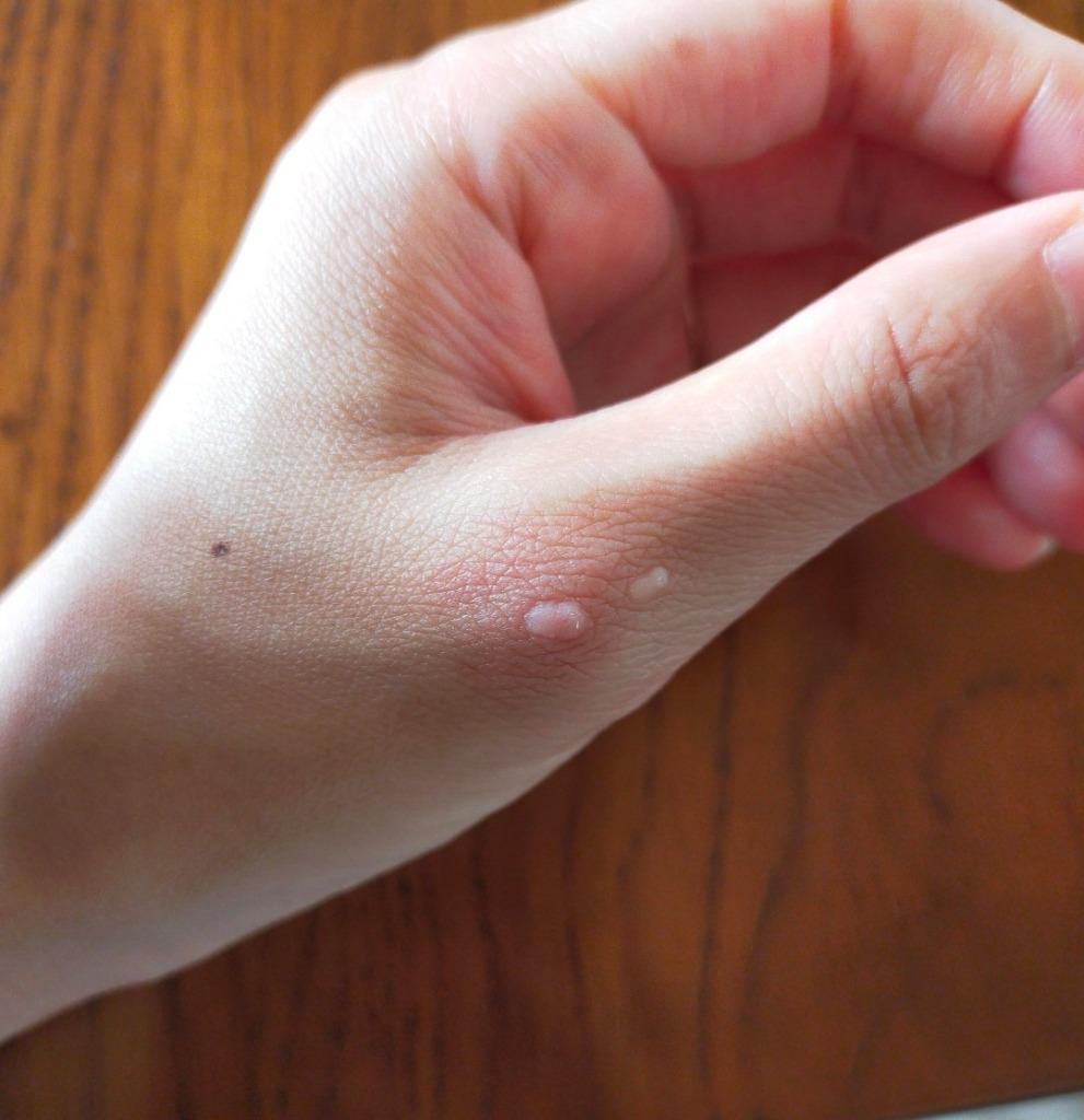 木酢液クリア100ml/メール便・送料無料/廃業のため在庫限り(5・6月には