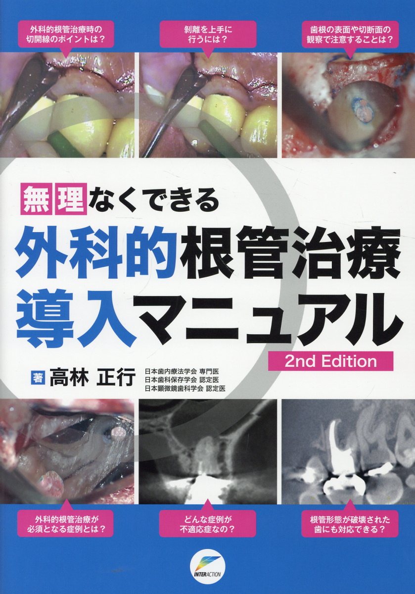 楽天市場】クインテッセンス出版 悩めるエンド難症例 診断のポイントと