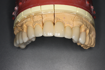 審美歯科 | 大泉学園 - 齋藤歯科医院