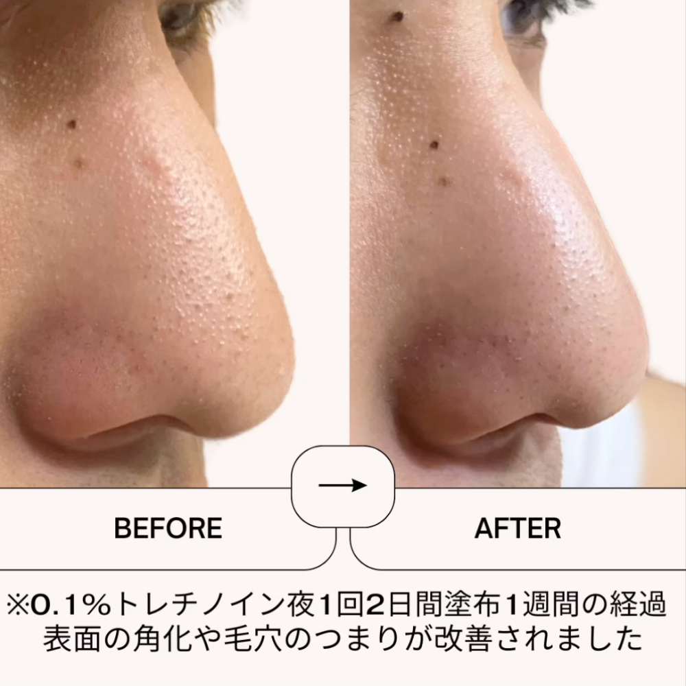 ゼオスキンヘルス デイリーPD 50ml – sakuraclinic-online