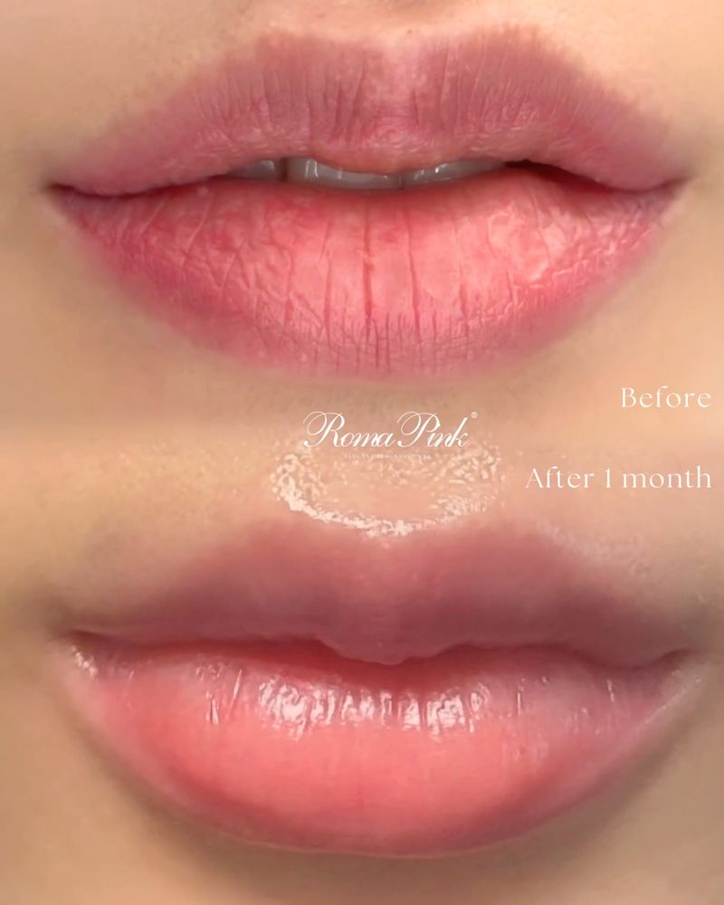 Roma pink 唇用セラム Roma pink 唇用セラム ローマピンク公式販売店