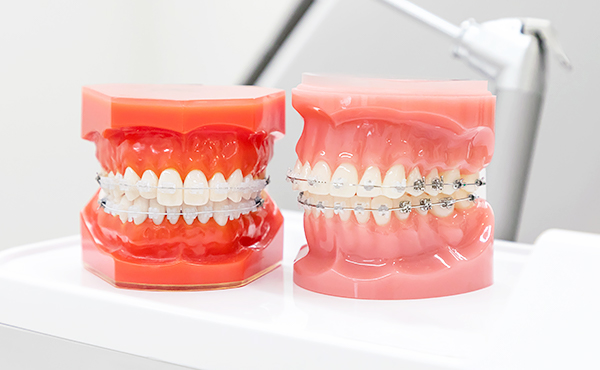 矯正歯科 | スカイツリー駅前ひまわり歯科クリニック