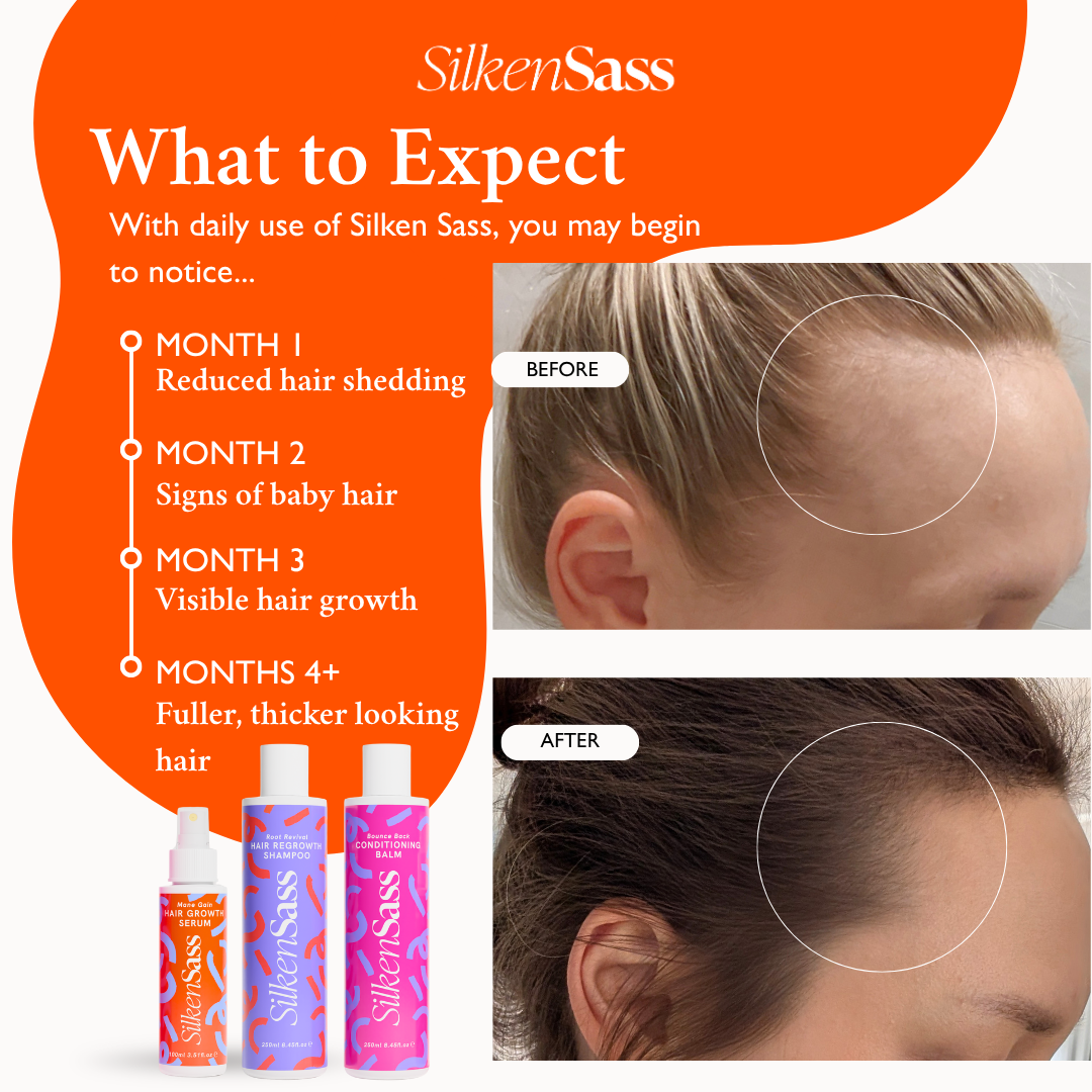 Essential Hair Growth System Bundle | Silken Sass