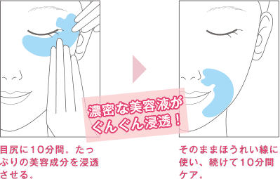 要問合せ】ロージードロップ パーフェクト ストレッチ シート – KOH