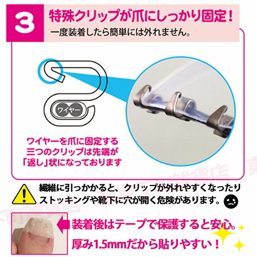 正規品 1個単品 まきづめリフト 4個クリップ 巻き爪 巻きづめ 矯正