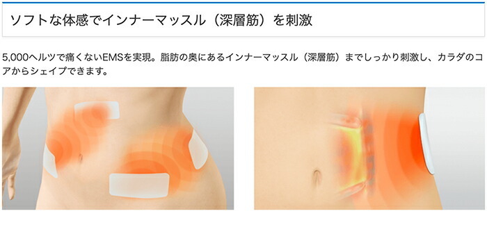 伊藤超短波株式会社 家庭用EMSマシン スタイリフト（STYLIFT