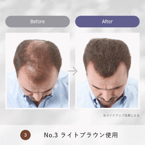 スーパーミリオンヘアーコンパクトセットNo.15ホワイト 10g+15mL