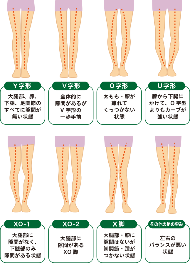東京渋谷のO脚・X脚矯正専門整体院「渋谷足改善センター®」