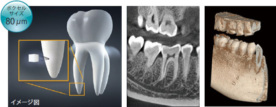最新の歯科用CT｜最先端のCT撮影による安全で確実な歯科治療｜3D画像