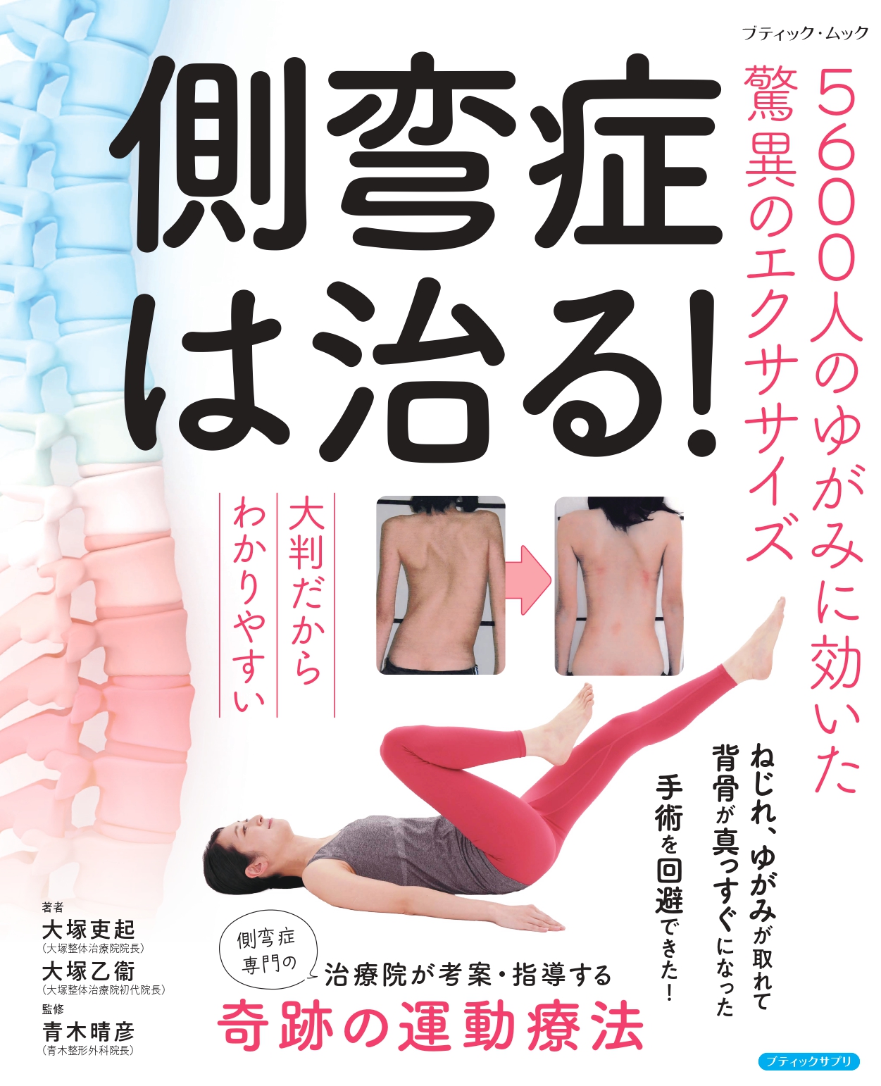 側湾症改善大塚式RHPI療法について | 東京にある大塚整体治療院