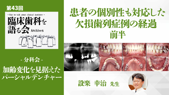 患者の個別性も対応した欠損歯列症例の経過 後半｜第43回 臨床歯科を