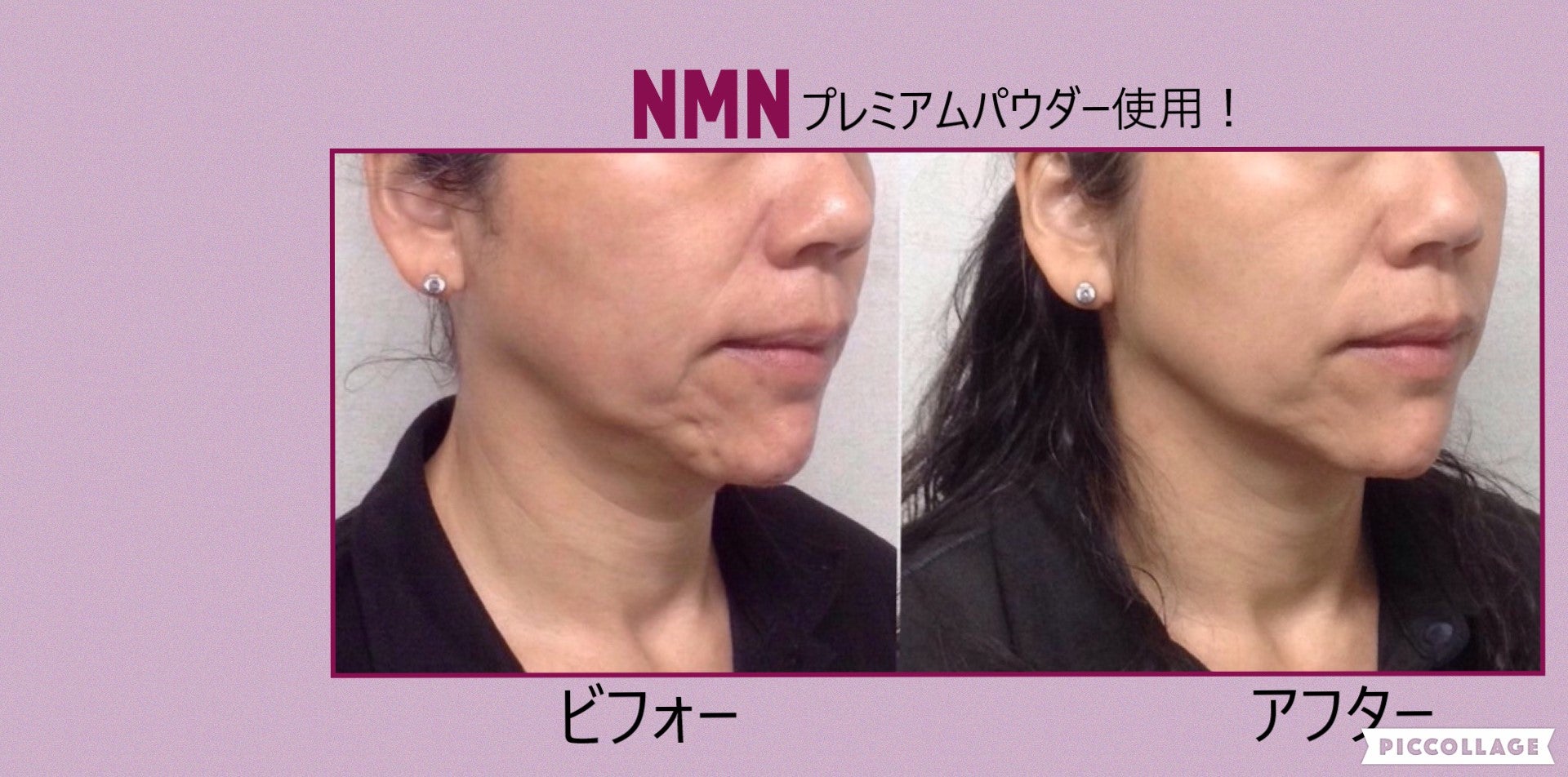 HERMOSAの若返りパウダー状美容液