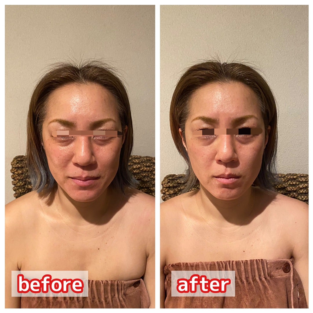 電気バリブラシとデンキバリカッサの違いってなに？ | 脱！老け顔